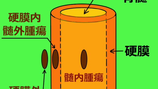 脊髄腫瘍の種類