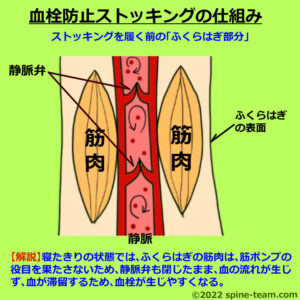 ストッキング仕組み（前）