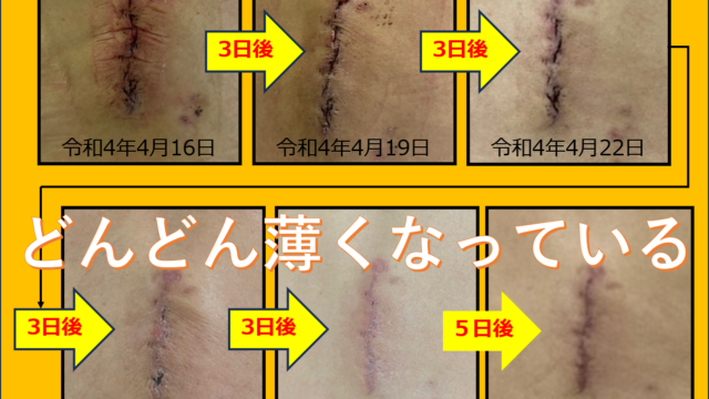 手術跡その１